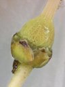 Arbutus unedo (Madro&ntilde;o) - Detalle del ovario tuberculado con el estilo surcado; hay restos del c&aacute;liz. (se ha quitado la corola)
